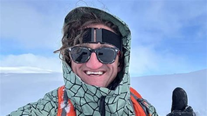 Casey Neistat Teeth: Did He Fix It?