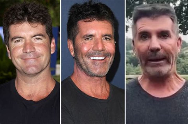 How Did Simon Cowell Break His Back? The Full Story