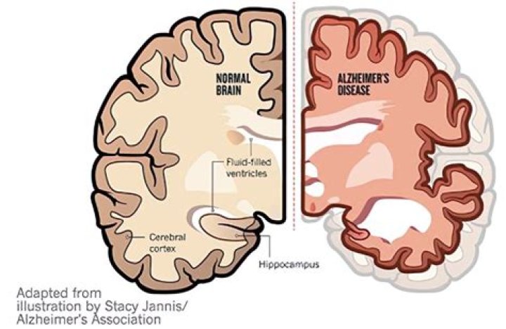 Tucker's Violent Outbursts Caused By Dementia